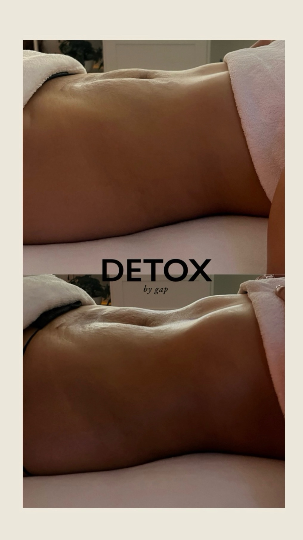 Detox By Gap In Dallas TX | Vagaro